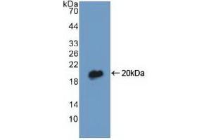 Detection of Recombinant DBI, Human using Polyclonal Antibody to Diazepam Binding Inhibitor (DBI) (Diazepam Binding Inhibitor 抗体  (AA 1-104))
