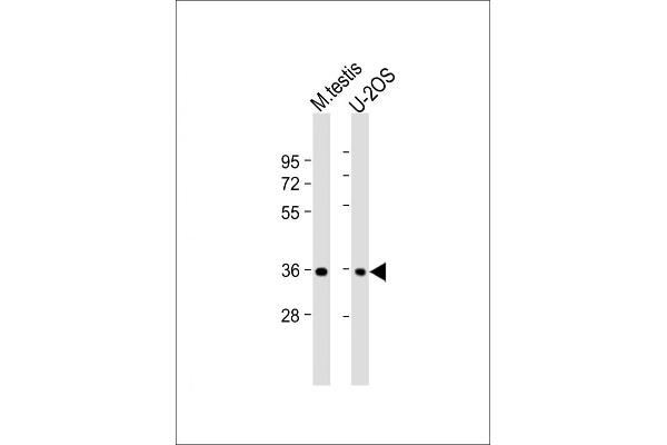 HEXIM2 anticorps  (AA 235-269)