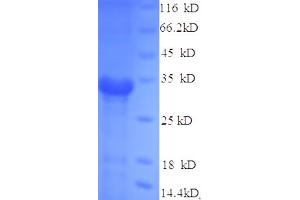 Antigen 85-A (AA 53-331), (partial) protein (His tag)