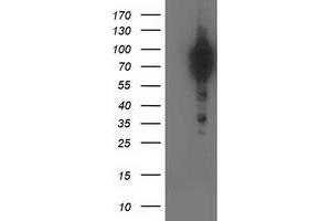 HEK293T cells were transfected with the pCMV6-ENTRY control (Left lane) or pCMV6-ENTRY BCAR1 (Right lane) cDNA for 48 hrs and lysed. (BCAR1 抗体)