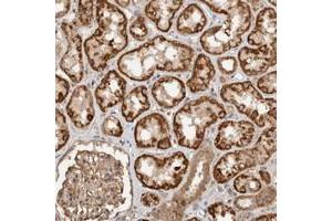 Immunohistochemical staining of human kidney with C9orf82 polyclonal antibody  shows distinct cytoplasmic positivity in cells in tubules. (Caspase Activity and Apoptosis Inhibitor 1 (CAAP1) 抗体)