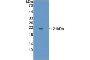 Detection of Recombinant KRT9, Human using Monoclonal Antibody to Cytokeratin 9 (CK9) (KRT9 抗体  (AA 315-456))