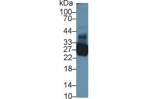 TNNI1 anticorps  (AA 1-187)