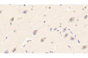 Detection of SIGLEC14 in Human Cerebrum Tissue using Polyclonal Antibody to Sialic Acid Binding Ig Like Lectin 14 (SIGLEC14) (SIGLEC14 抗体  (AA 24-137))