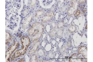 Immunoperoxidase of monoclonal antibody to AMBP on formalin-fixed paraffin-embedded human kidney. (AMBP 抗体)