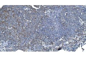 IHC analysis of DRP1/DNM1L using anti-DRP1/DNM1L antibody (ABIN7602180). (Dynamin 1-Like 抗体  (AA 618-736))