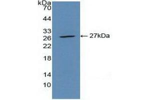 Detection of Recombinant CLEC10A, Mouse using Polyclonal Antibody to Cluster Of differentiation 301 (CD301) (CLEC10A 抗体  (AA 69-273))