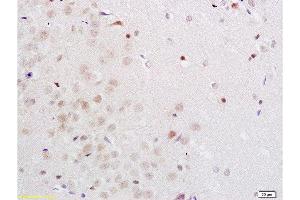 Formalin-fixed and rat brain tissue labeled with Anti-Midnolin Polyclonal Antibody, Unconjugated  1:200 followed by conjugation to the secondary antibody and DAB staining (MIDN 抗体  (AA 51-150))