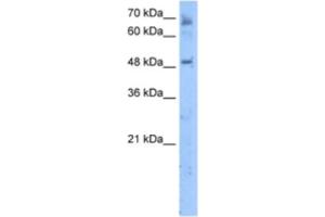 Western Blotting (WB) image for anti-Membrane Bound O-Acyltransferase Domain Containing 7 (MBOAT7) antibody (ABIN2463293) (MBOAT7 抗体)