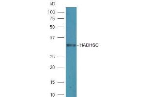 Mouse liver lysates probed with Rabbit Anti-HADHSC Polyclonal Antibody  at 1:5000 90min in 37˚C.