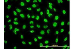Image no. 2 for anti-serine/threonine Kinase 38 (STK38) (AA 1-466) antibody (ABIN599179) (STK38 抗体  (AA 1-466))