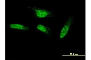 Immunofluorescence of monoclonal antibody to SEC14L2 on HeLa cell. (SEC14L2 抗体  (AA 101-199))