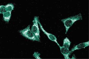 Immunofluorescence staining of HeLa cells (Human cervical epitheloid carcinoma, ATCC CCL-2. (ITGB1 抗体  (AA 76-256))