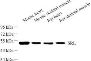Western blot analysis of Srl (ABIN7075508) at dilution of 1: 500 (Sarcalumenin 抗体)