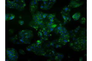 Immunofluorescent staining of HepG2 cells using anti-ALDH2 mouse monoclonal antibody (ABIN2452752).