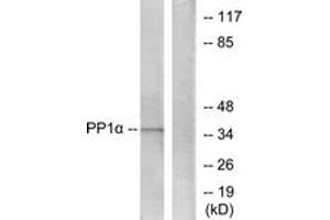 Western Blotting (WB) image for anti-Protein Phosphatase 1, Catalytic Subunit, alpha Isoform (PPP1CA) (AA 281-330) antibody (ABIN1532484)