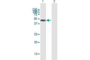 Western Blot analysis of C2CD2 expression in transfected 293T cell line by C2CD2 MaxPab polyclonal antibody. (C2CD2 抗体  (AA 1-388))