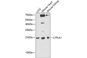 Western blot analysis of extracts of various cell lines, using LYPL antibody (ABIN1680728, ABIN3018907, ABIN3018908 and ABIN6220622) at 1:3000 dilution. (LYPLA1 抗体  (AA 1-230))