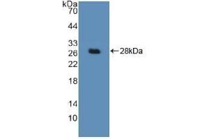 Detection of Recombinant DDB2, Human using Polyclonal Antibody to Damage Specific DNA Binding Protein 2 (DDB2) (DDB2 抗体  (AA 166-383))