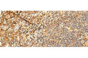 Immunohistochemistry of paraffin-embedded Human tonsil tissue using PPM1B Polyclonal Antibody at dilution of 1:50(x200) (PPM1B 抗体)