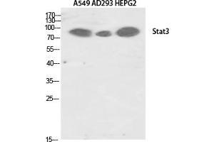 Western Blotting (WB) image for anti-Signal Transducer and Activator of Transcription 3 (Acute-Phase Response Factor) (STAT3) (Tyr705) antibody (ABIN5961851) (STAT3 抗体  (Tyr705))