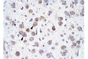 RALY antibody was used for immunohistochemistry at a concentration of 4-8 ug/ml to stain Neural cells (arrows) in Human Brain. (Raly 抗体  (N-Term))