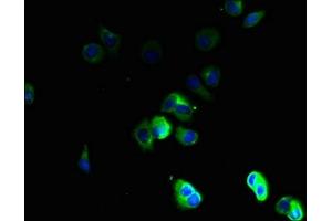 Immunofluorescent analysis of MCF-7 cells using ABIN7171858 at dilution of 1:100 and Alexa Fluor 488-congugated AffiniPure Goat Anti-Rabbit IgG(H+L) (Tetraspanin 16 抗体  (AA 116-160))