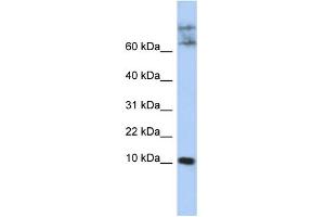 WB Suggested Anti-CKLF Antibody Titration:  0. (CKLF 抗体  (N-Term))