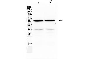 Western blot analysis of PTP1B using anti-PTP1B antibody .