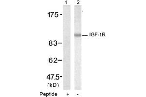 Image no. 2 for anti-Insulin-Like Growth Factor 1 Receptor (IGF1R) (Tyr1346) antibody (ABIN319345) (IGF1R 抗体  (Tyr1346))