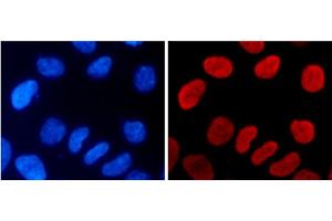 Immunofluorescence analysis of 293T cells using MonoMethyl-Histone H3-K9 Polyclonal Antibody (Histone 3 抗体  (meLys9))