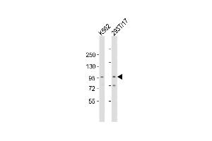 All lanes : Anti-Rai17 Antibody  at 1:2000 dilution Lane 1: K562 whole cell lysates Lane 2: 293T/17 whole cell lysates Lysates/proteins at 20 μg per lane. (ZMIZ1 抗体  (C-Term))