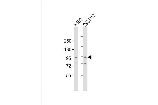 ZMIZ1 antibody  (C-Term)