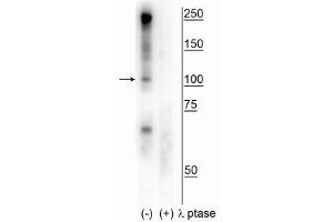 Western blot of human T47D cell lysate showing specific immunolabeling of the ~100 kDa CtIP phosphorylated at Ser327 in the first lane (-). (Retinoblastoma Binding Protein 8 抗体  (pSer327))