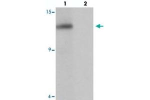 Western blot analysis of SDHAF2 in rat liver tissue with SDHAF2 polyclonal antibody  at 1 ug/mL in (lane 1) the absence and (lane 2) the presence of blocking peptide. (Sdhaf2 抗体  (N-Term))