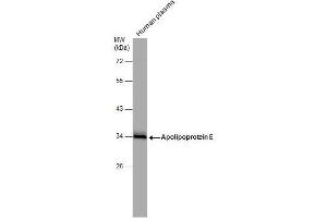 WB Image Human tissue extract (30 μg) was separated by 10% SDS-PAGE, and the membrane was blotted with Apolipoprotein E antibody , diluted at 1:1000. (APOE 抗体  (N-Term))