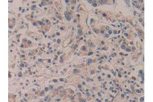 Immunohistochemistry (IHC) image for anti-Amyloid beta (A4) Precursor Protein-Binding, Family A, Member 2 (APBA2) (AA 459-722) antibody (ABIN5013121)