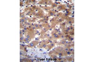 UBE2NL Antibody (N-term) immunohistochemistry analysis in formalin fixed and paraffin embedded human liver tissue followed by peroxidase conjugation of the secondary antibody and DAB staining. (UBE2NL 抗体  (N-Term))