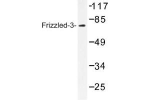 Image no. 1 for anti-Frizzled Family Receptor 3 (FZD3) antibody (ABIN317640) (FZD3 抗体)