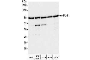 Western Blotting (WB) image for anti-Fused in Sarcoma (FUS) (AA 400-450) antibody (ABIN7453433) (FUS 抗体  (AA 400-450))