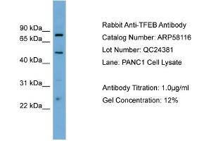 WB Suggested Anti-TFEB  Antibody Titration: 0. (TFEB 抗体  (Middle Region))