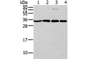 Western Blotting (WB) image for anti-Chromobox Homolog 7 (CBX7) antibody (ABIN5960243) (CBX7 抗体)