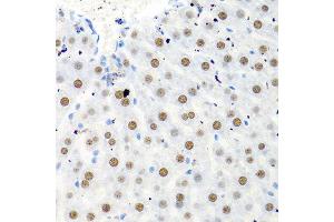 Immunohistochemistry of paraffin-embedded rat liver using PTBP1 antibody at dilution of 1:100 (40x lens). (PTBP1 抗体)