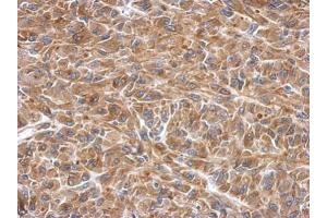 IHC-P Image Immunohistochemical analysis of paraffin-embedded U87 xenograft, using SLK, antibody at 1:500 dilution. (SLK 抗体)