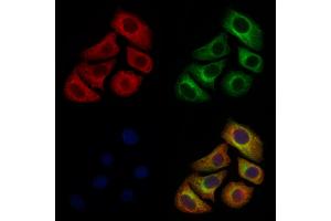 ABIN6261523 and ABIN6277133 staining Hela cells by IF/ICC. (ELSPBP1 抗体  (C-Term))