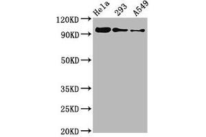 Western Blot Positive WB detected in Hela whole cell lysate ?
