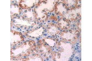 Used in DAB staining on fromalin fixed paraffin- embedded kidney tissue (GLUD1 抗体  (AA 334-556))