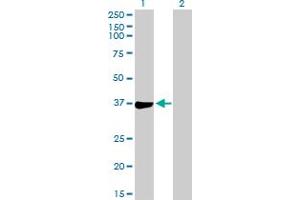 Western Blot analysis of PHF11 expression in transfected 293T cell line by PHF11 MaxPab polyclonal antibody. (PHF11 抗体  (AA 1-292))