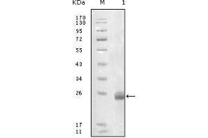 Western blot analysis using FBLN5 mouse mAb against truncated FBLN5-His recombinant protein. (Fibulin 5 抗体  (AA 242-448))