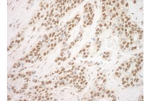 Immunohistochemistry (IHC) image for anti-Pogo Transposable Element with ZNF Domain (POGZ) (AA 1360-1410) antibody (ABIN7448730)